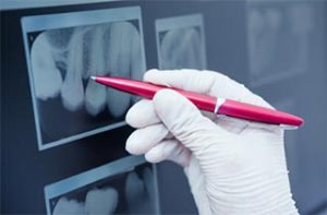 Granbury digital dental xray