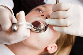 dental extractions